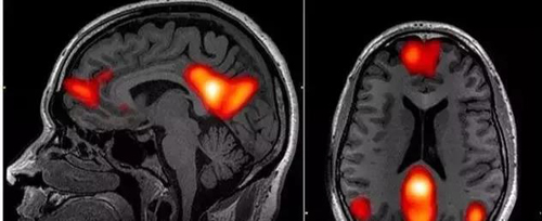 【西安精神心理医院】抑郁症对你的大脑做了什么? 【西安精神心理医院】抑郁症对你的大脑做了什么?